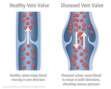 Venous Medicine